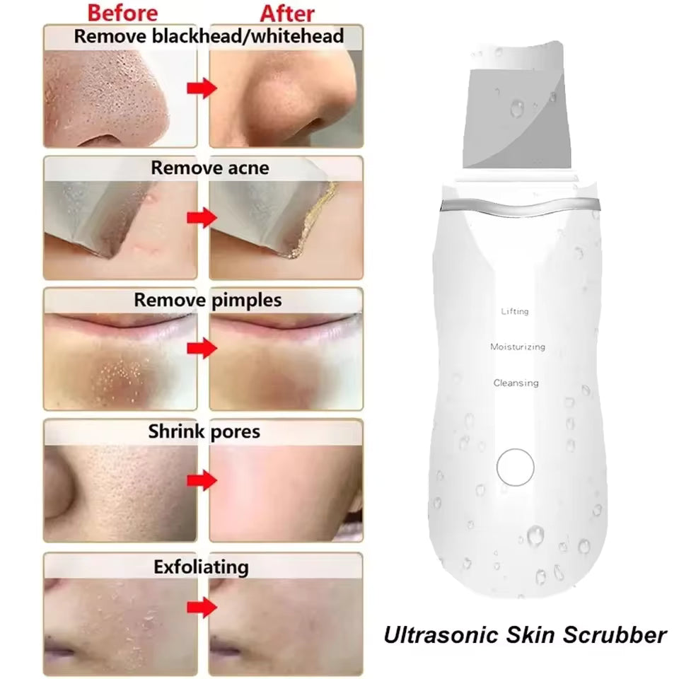 Limpiador facial electrico