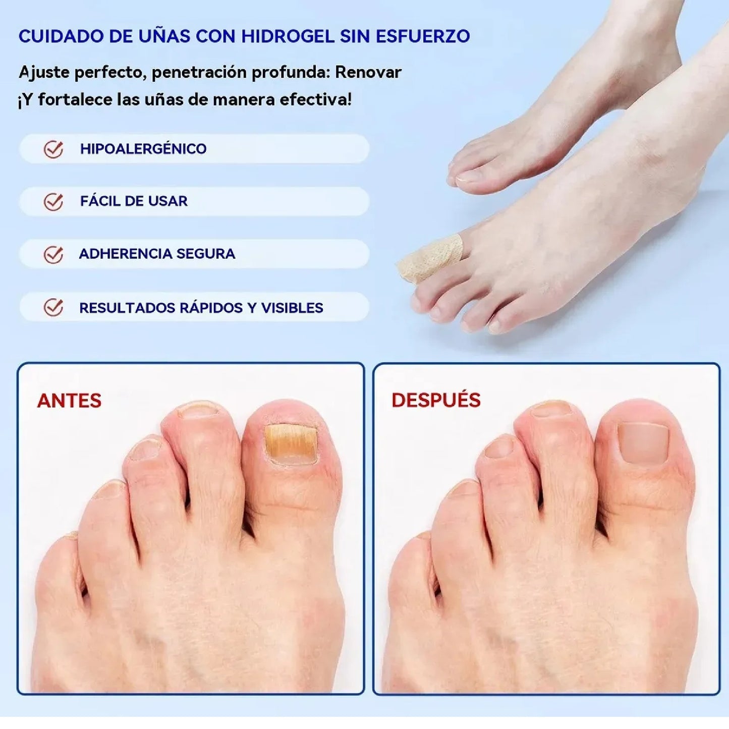 Parche hongo De Uñas (PACK 2)