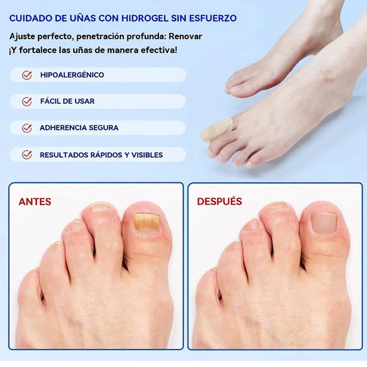 Parche hongo De Uñas (PACK 2)