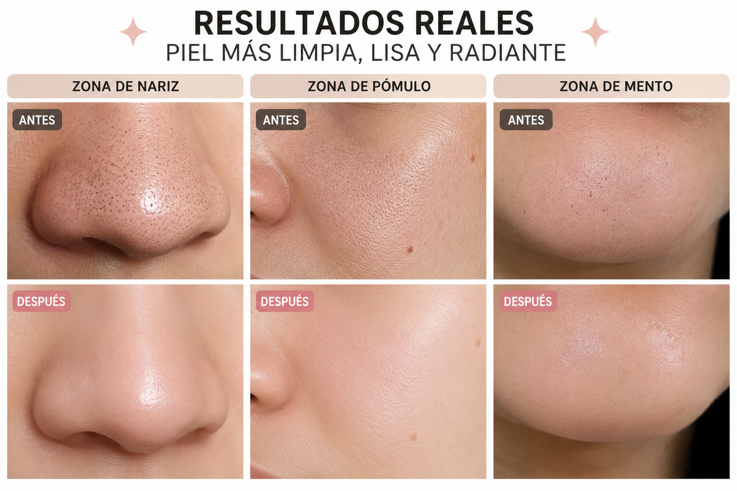 Limpiador facial electrico